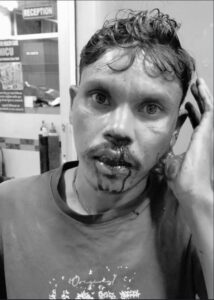 आदित्यपुर : छोटा हाथी वाहन के चालक को अज्ञात युवको ने मारकर किया घायल, गंभीर रूप से किया जख्मी