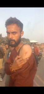 आदित्यपुर: शर्मा बस्ती में  घर मे घुसकर युवक पर जानलेवा हमला, घर के बाहर हवाई फायरिंग।