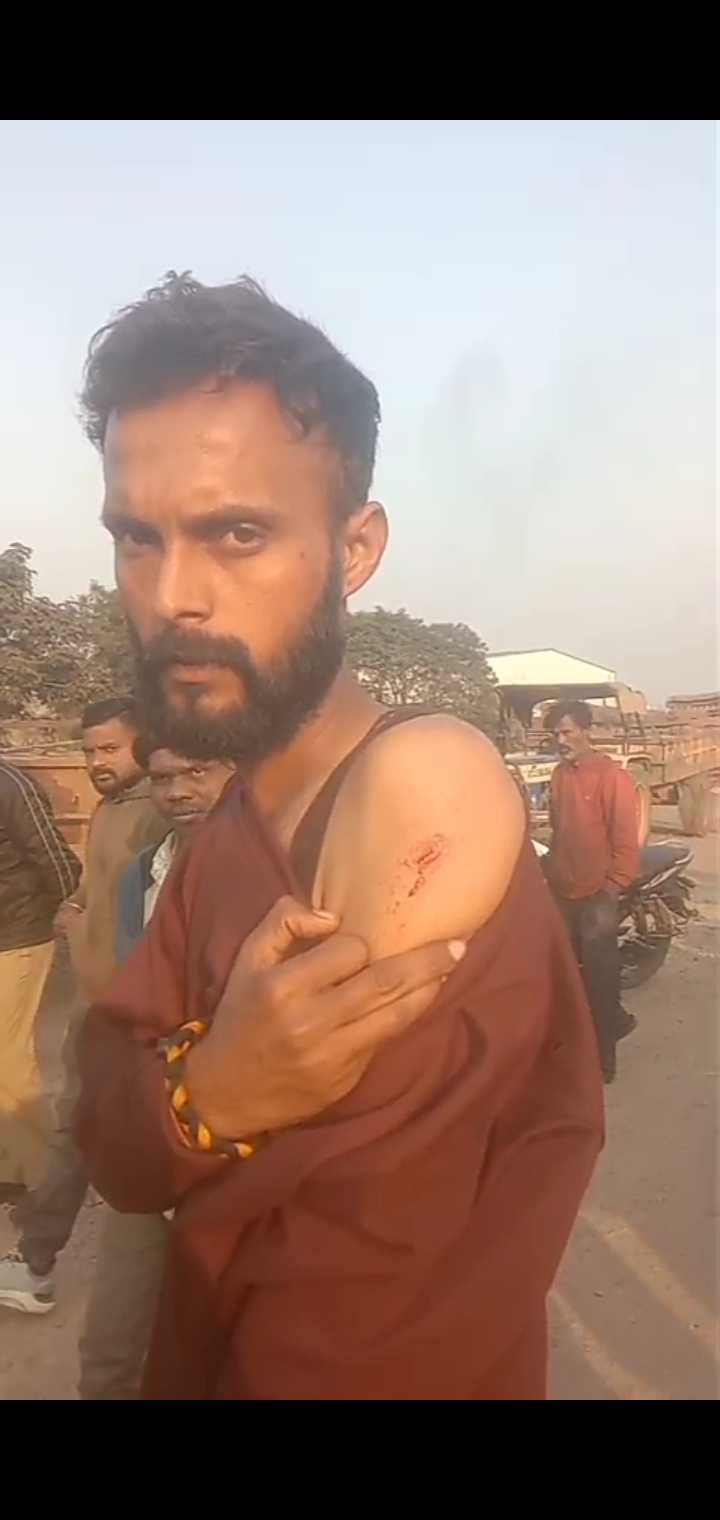 आदित्यपुर: शर्मा बस्ती में  घर मे घुसकर युवक पर जानलेवा हमला, घर के बाहर हवाई फायरिंग।